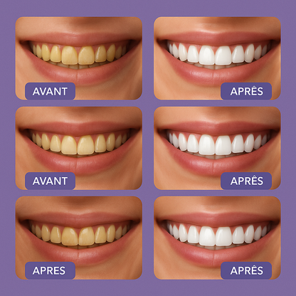 Blanchisseur Dentaire - V34™ Serum